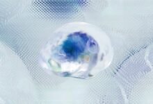 business intelligence data analysis